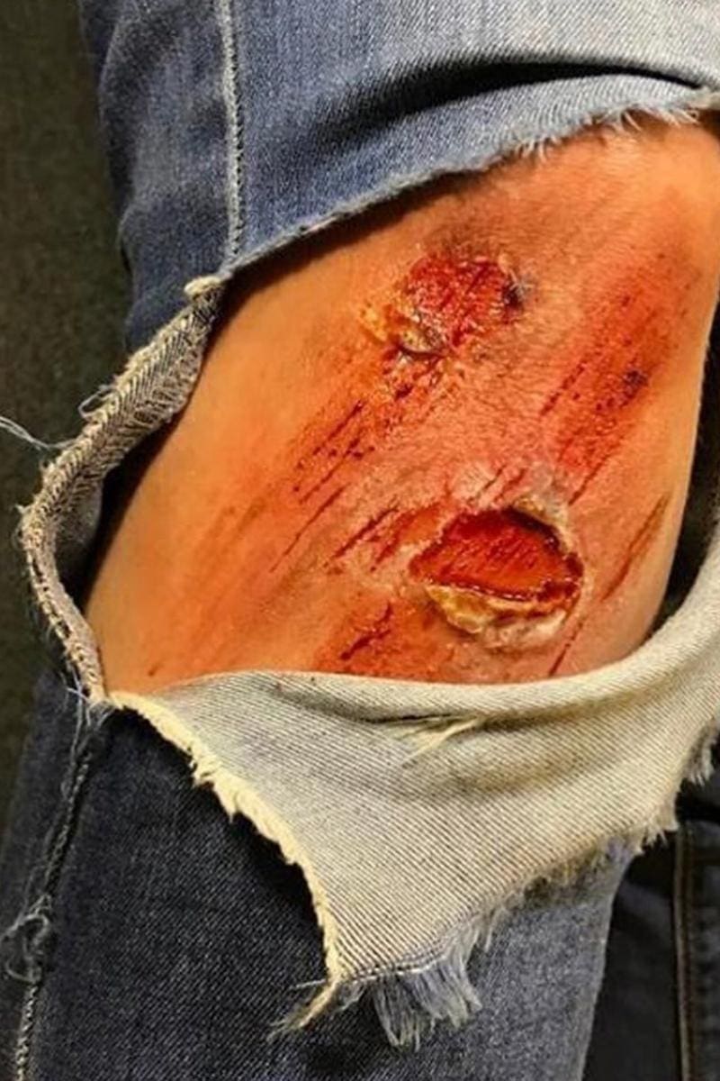 Grazed Knee SFX Makeup