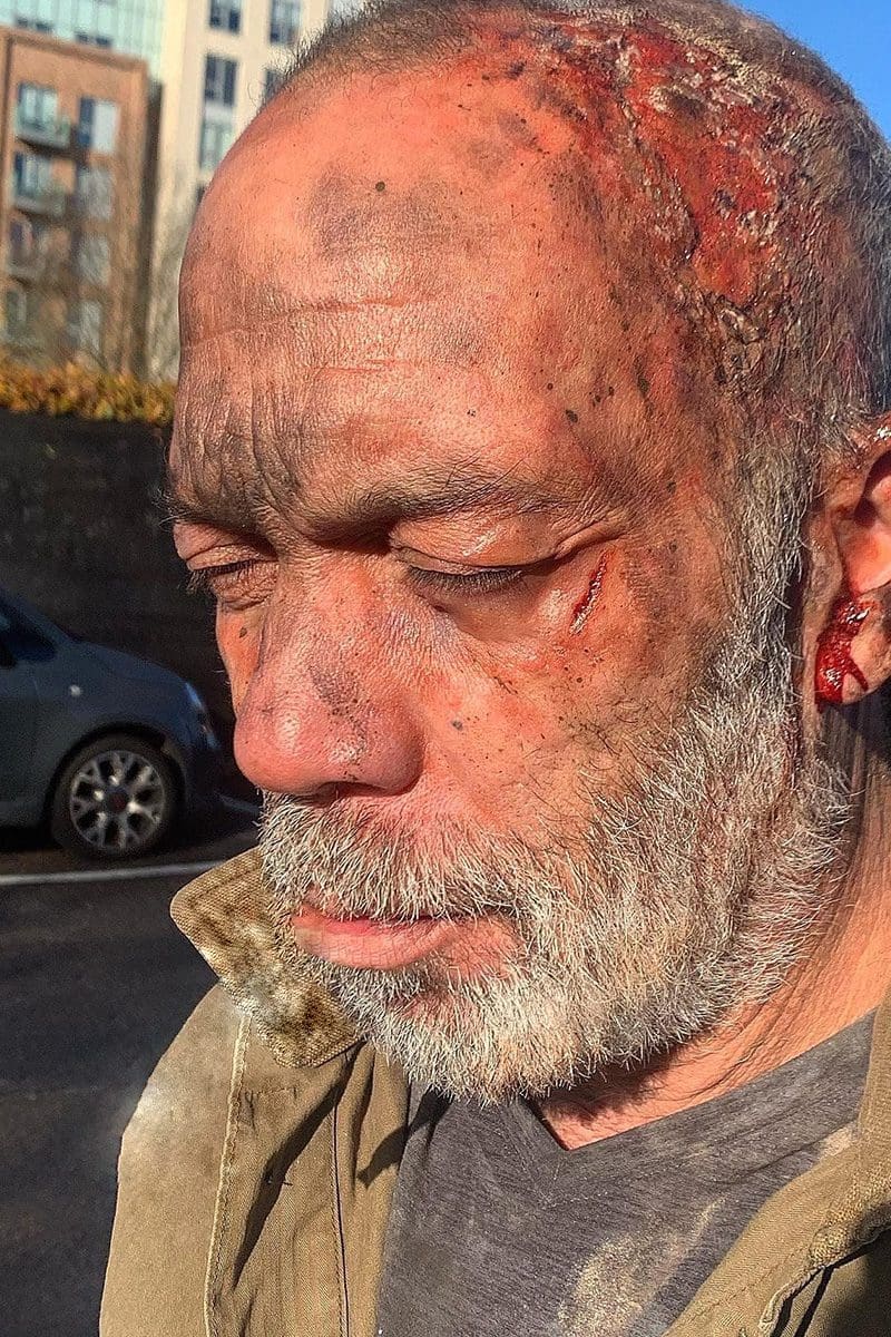 Man with Scars and cuts SFX