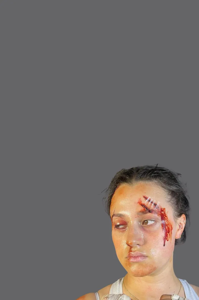 Bald cap and prosthetics