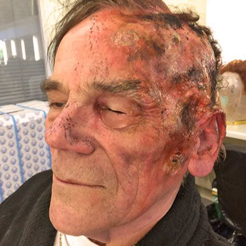 SFX Makeup Head Wound SFX Makeup Head Wound