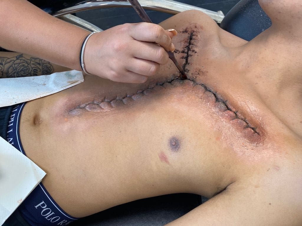SFX Makeup Scars and Wounds